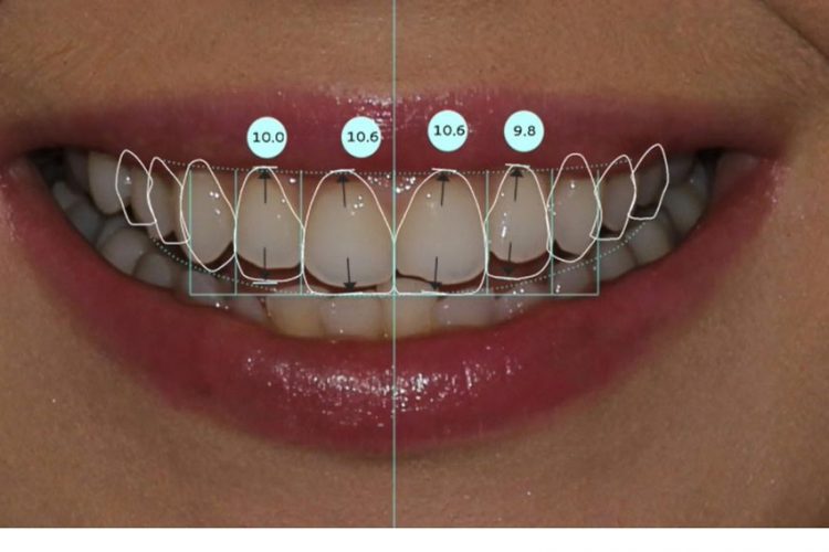 Dental Design Procedures