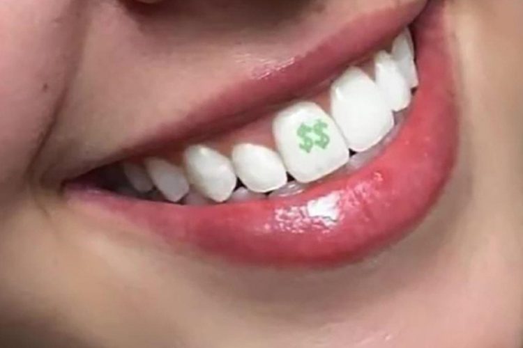 Tooth Tattoos And What They Add To Your Smile – Good Art & Design